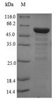 EIF3M / PCID1 Protein - (Tris-Glycine gel) Discontinuous SDS-PAGE (reduced) with 5% enrichment gel and 15% separation gel.