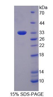 EIF3M / PCID1 Protein - Recombinant Eukaryotic Translation Initiation Factor 3M (EIF3M) by SDS-PAGE