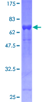 EIF3S5 / EIF3F Protein - 12.5% SDS-PAGE of human EIF3S5 stained with Coomassie Blue