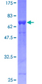 EIF3S5 / EIF3F Protein - 12.5% SDS-PAGE of human EIF3S5 stained with Coomassie Blue