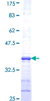 EIF3S5 / EIF3F Protein - 12.5% SDS-PAGE Stained with Coomassie Blue.