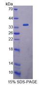EIF4A1 Protein - Recombinant Eukaryotic Translation Initiation Factor 4A1 (EIF4A1) by SDS-PAGE