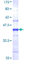 EIF4A2 Protein - 12.5% SDS-PAGE Stained with Coomassie Blue.