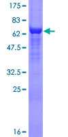 EIF4A3 Protein - 12.5% SDS-PAGE of human DDX48 stained with Coomassie Blue