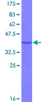 EIF4A3 Protein - 12.5% SDS-PAGE Stained with Coomassie Blue.