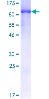 EIF4B Protein - 12.5% SDS-PAGE of human EIF4B stained with Coomassie Blue