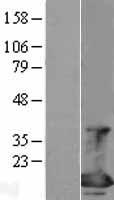 EIF4EBP1 / 4EBP1 Protein - Western validation with an anti-DDK antibody * L: Control HEK293 lysate R: Over-expression lysate