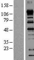 EIF4ENIF1 / 4E-T Protein - Western validation with an anti-DDK antibody * L: Control HEK293 lysate R: Over-expression lysate