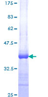 EIF4G1 / EIF4G Protein - 12.5% SDS-PAGE Stained with Coomassie Blue.