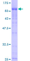 EIF4G3 Protein - 12.5% SDS-PAGE of human EIF4G3 stained with Coomassie Blue