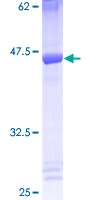 EIF5A Protein - 12.5% SDS-PAGE of human EIF5A stained with Coomassie Blue