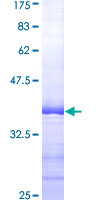 EIF5A Protein - 12.5% SDS-PAGE Stained with Coomassie Blue.