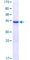 EIF5A2 Protein - 12.5% SDS-PAGE of human EIF5A2 stained with Coomassie Blue