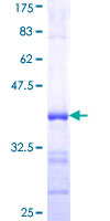 EIF5A2 Protein - 12.5% SDS-PAGE Stained with Coomassie Blue.