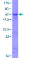 EIF6 Protein - 12.5% SDS-PAGE of human EIF6 stained with Coomassie Blue