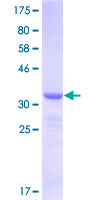 EIF6 Protein - 12.5% SDS-PAGE Stained with Coomassie Blue.