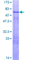 EKLF / KLF1 Protein - 12.5% SDS-PAGE of human KLF1 stained with Coomassie Blue