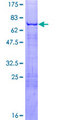 EKLF / KLF1 Protein - 12.5% SDS-PAGE of human KLF1 stained with Coomassie Blue