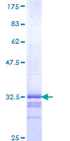 EKLF / KLF1 Protein - 12.5% SDS-PAGE Stained with Coomassie Blue.
