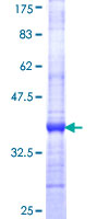ELAC1 Protein - 12.5% SDS-PAGE Stained with Coomassie Blue.