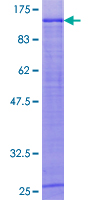 ELAC2 Protein - 12.5% SDS-PAGE of human ELAC2 stained with Coomassie Blue