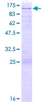 ELF1 Protein - 12.5% SDS-PAGE of human ELF1 stained with Coomassie Blue