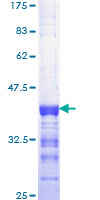 ELF1 Protein - 12.5% SDS-PAGE Stained with Coomassie Blue.