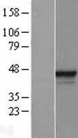ELF3 / ESE1 Protein - Western validation with an anti-DDK antibody * L: Control HEK293 lysate R: Over-expression lysate