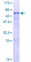 ELF3 / ESE1 Protein - 12.5% SDS-PAGE of human ELF3 stained with Coomassie Blue