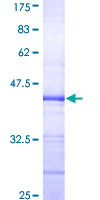 ELF3 / ESE1 Protein - 12.5% SDS-PAGE Stained with Coomassie Blue.