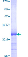 ELF4 / MEF Protein - 12.5% SDS-PAGE Stained with Coomassie Blue.