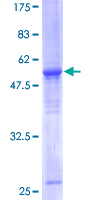 ELF5 Protein - 12.5% SDS-PAGE of human ELF5 stained with Coomassie Blue