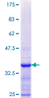 ELF5 Protein - 12.5% SDS-PAGE Stained with Coomassie Blue.