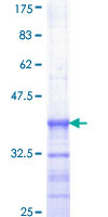 ELK1 Protein - 12.5% SDS-PAGE Stained with Coomassie Blue.