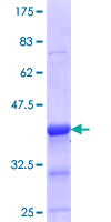 ELK3 / NET Protein - 12.5% SDS-PAGE Stained with Coomassie Blue.