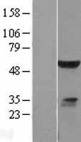 ELK4 Protein - Western validation with an anti-DDK antibody * L: Control HEK293 lysate R: Over-expression lysate