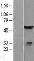 ELK4 Protein - Western validation with an anti-DDK antibody * L: Control HEK293 lysate R: Over-expression lysate
