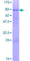 ELK4 Protein - 12.5% SDS-PAGE of human ELK4 stained with Coomassie Blue