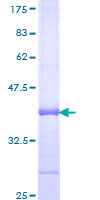ELL / MEN Protein - 12.5% SDS-PAGE Stained with Coomassie Blue.