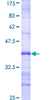 ELMO1 / ELMO 1 Protein - 12.5% SDS-PAGE Stained with Coomassie Blue.