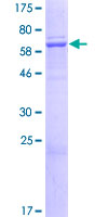 ELMOD1 Protein - 12.5% SDS-PAGE of human ELMOD1 stained with Coomassie Blue