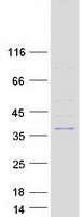 ELMOD1 Protein - Purified recombinant protein ELMOD1 was analyzed by SDS-PAGE gel and Coomassie Blue Staining