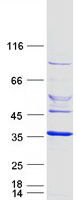 ELMOD2 Protein - Purified recombinant protein ELMOD2 was analyzed by SDS-PAGE gel and Coomassie Blue Staining