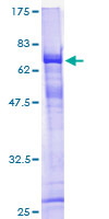 ELMOD3 Protein - 12.5% SDS-PAGE of human RBED1 stained with Coomassie Blue