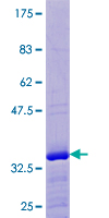 ELOF1 Protein - 12.5% SDS-PAGE of human ELOF1 stained with Coomassie Blue