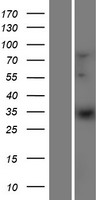 ELOVL1 Protein - Western validation with an anti-DDK antibody * L: Control HEK293 lysate R: Over-expression lysate