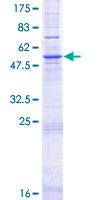 ELOVL2 Protein - 12.5% SDS-PAGE of human ELOVL2 stained with Coomassie Blue