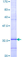 ELOVL4 Protein - 12.5% SDS-PAGE Stained with Coomassie Blue.