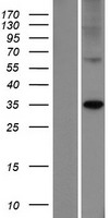 ELOVL7 Protein - Western validation with an anti-DDK antibody * L: Control HEK293 lysate R: Over-expression lysate