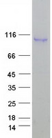 ELP2 / STATIP1 Protein - Purified recombinant protein ELP2 was analyzed by SDS-PAGE gel and Coomassie Blue Staining